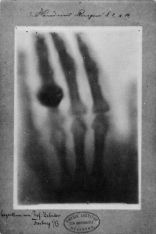 Anna Röntgen`s hand, picture taken by her husband on December 22, 1895