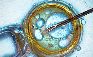 Needle and cell