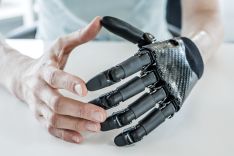 Bionische Handprothese von Dr. Stefan Schulz und Team